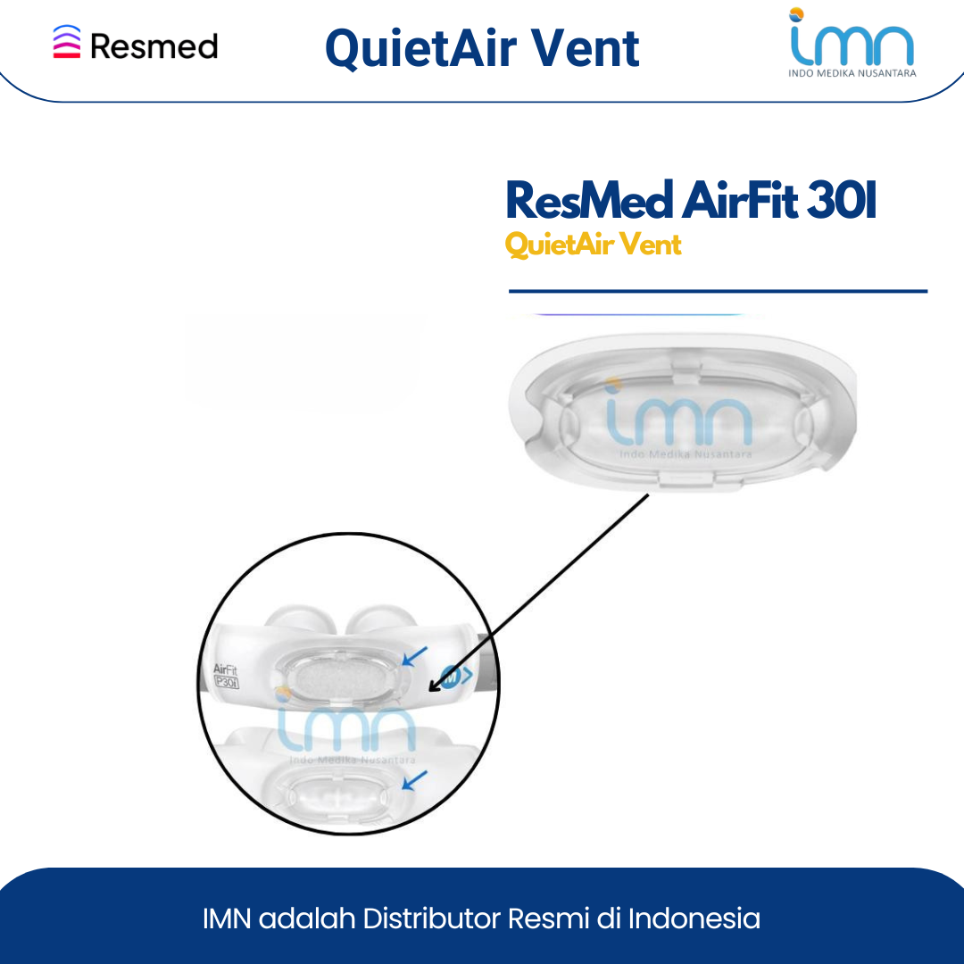 Resmed QuiteAir Vent