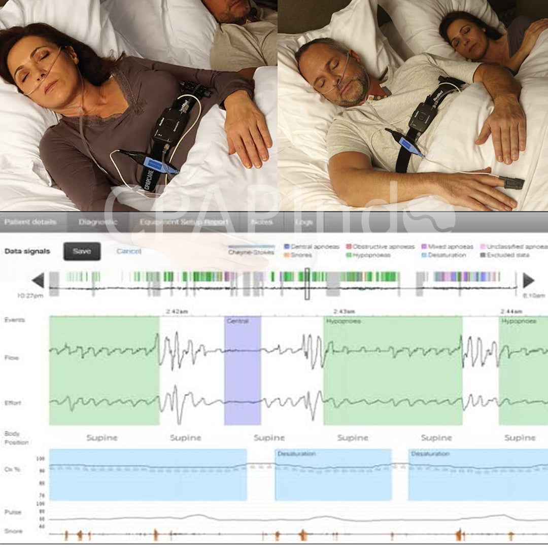 Home Sleep Evaluation for Sleep Apnea